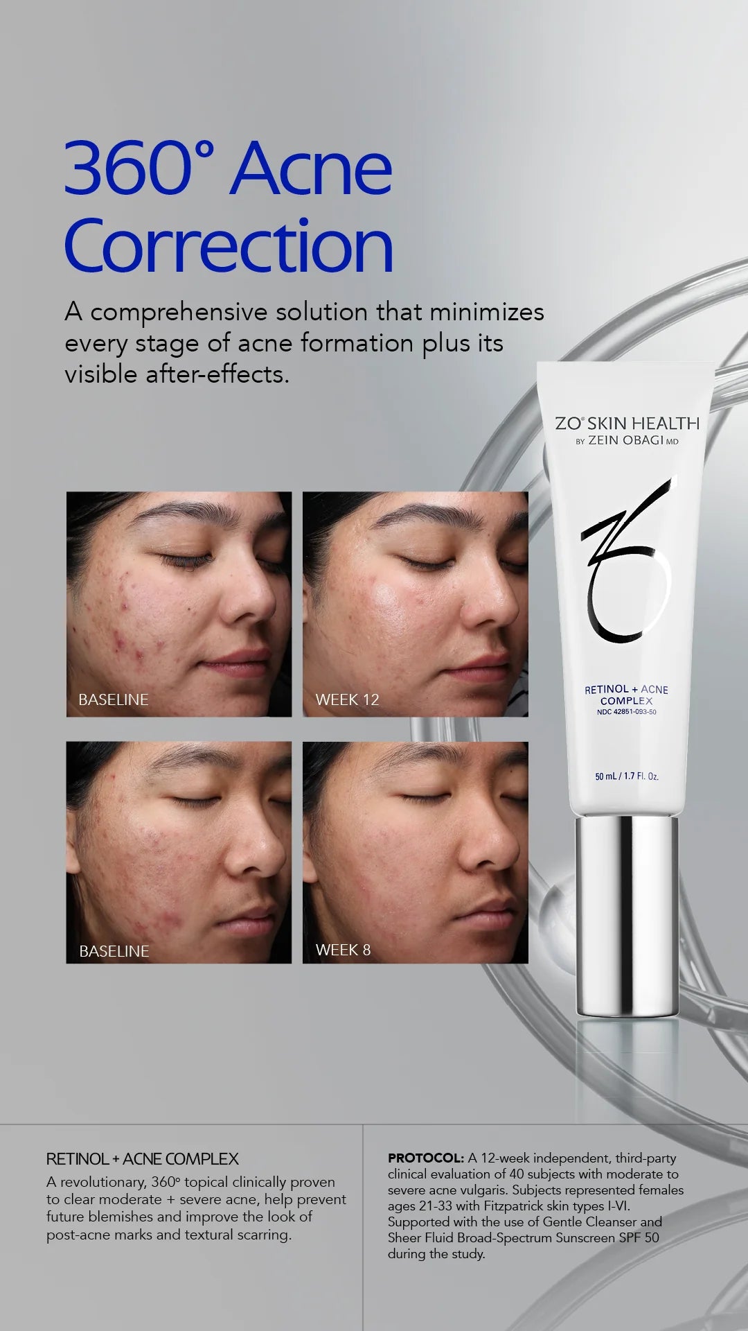 Retinol + Blemish Complex